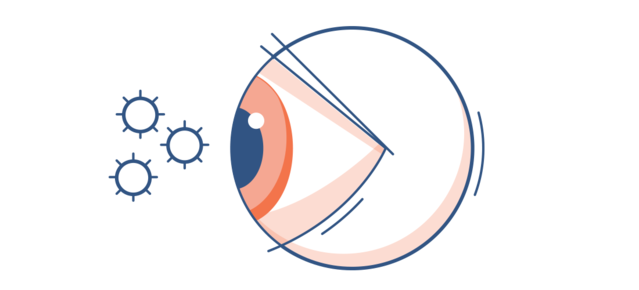 Illustration of a red eye with pollen particles in the surround air
